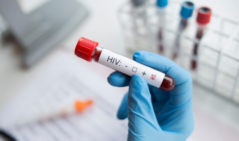 VIH test : un dépistage sans frais et sans ordonnance